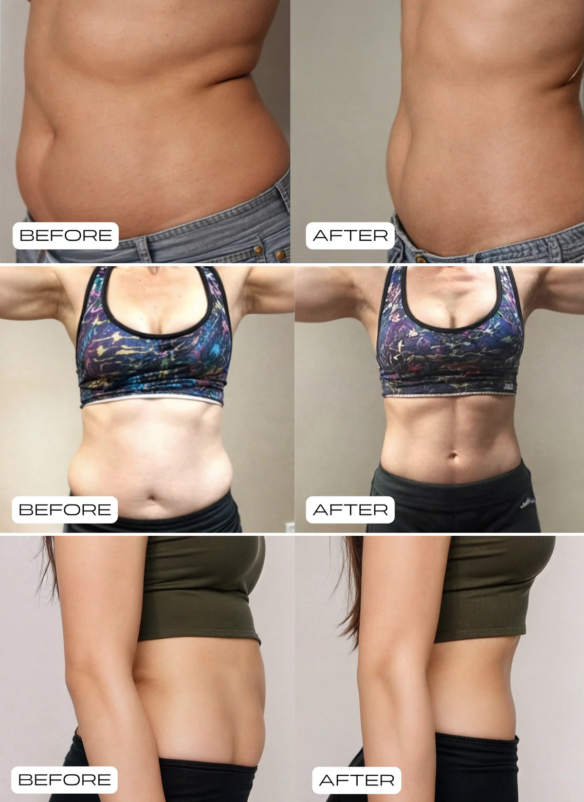 Pilates Reformer Set