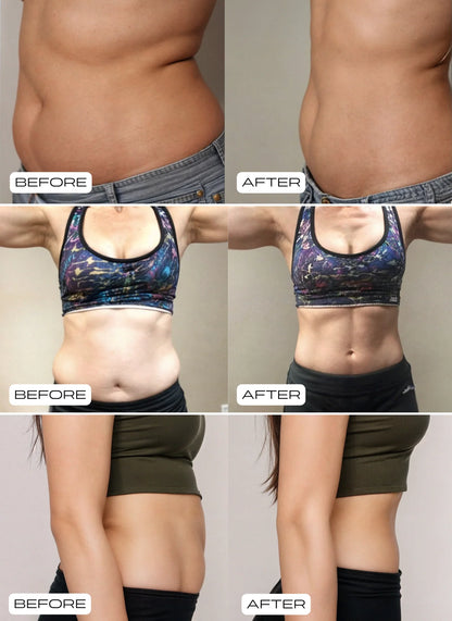 Pilates Reformer Set